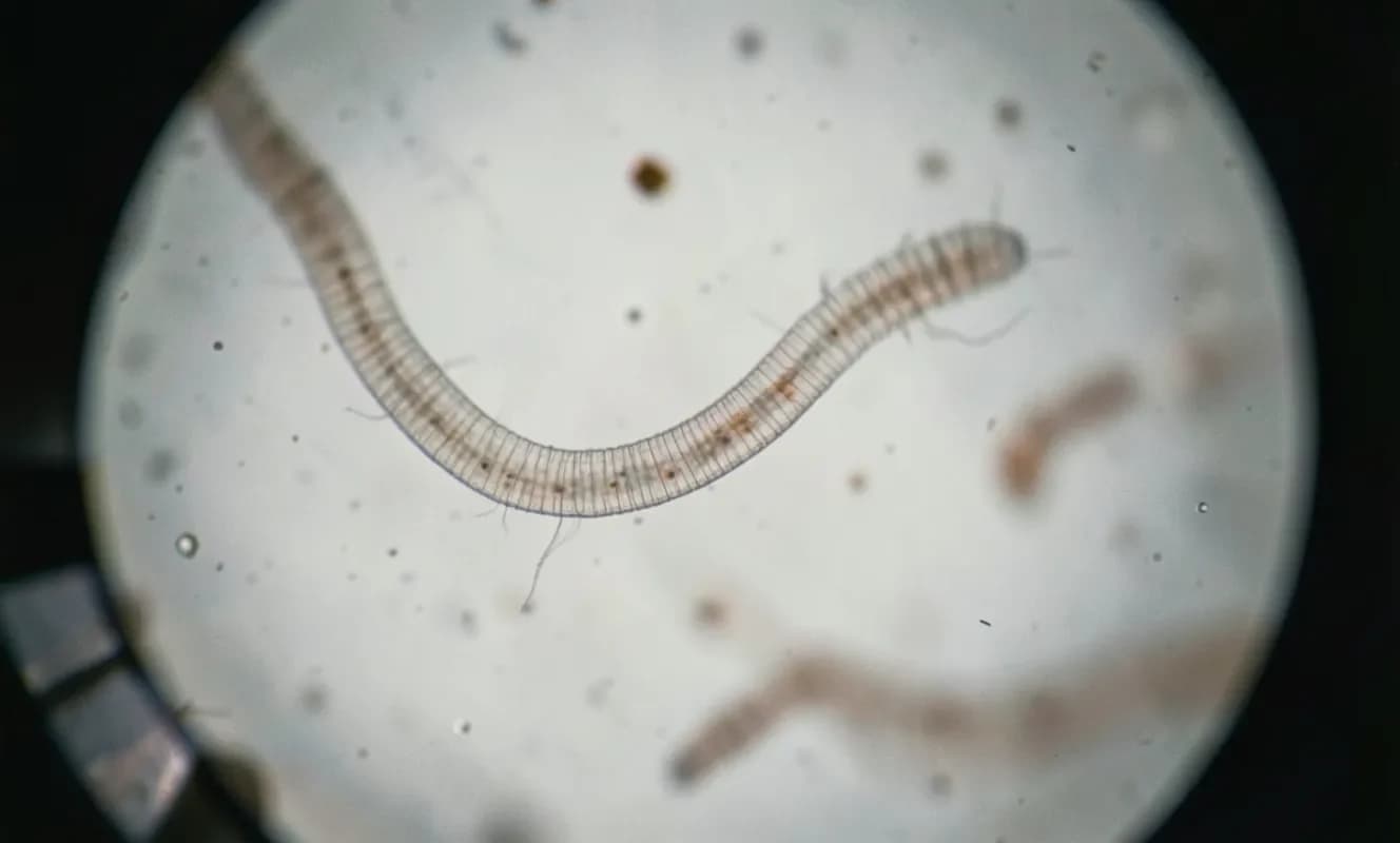 Vitamin B12 Verheij Sendromu Modelinde Gelişimsel Bozuklukları Düzeltiyor