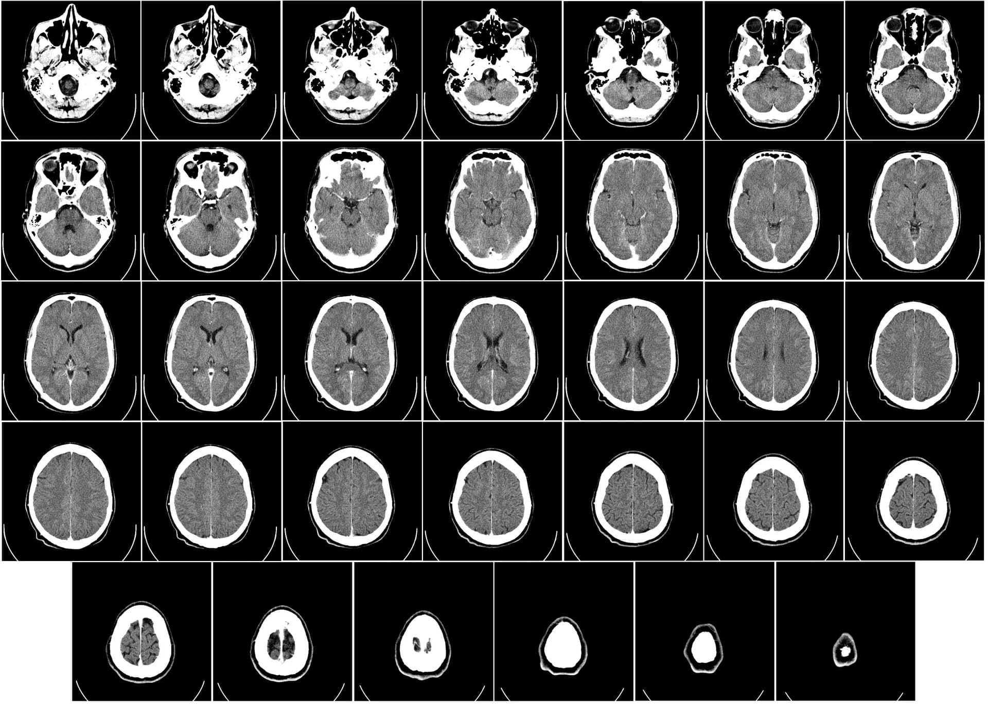 Nuevo método para visualizar en 3D la distribución de nanoplásticos en el cerebro de ratones